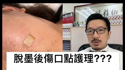 脫墨面相|脫墨之後要注意什麼事項？傷口如何護理？如何預防墨的形成？